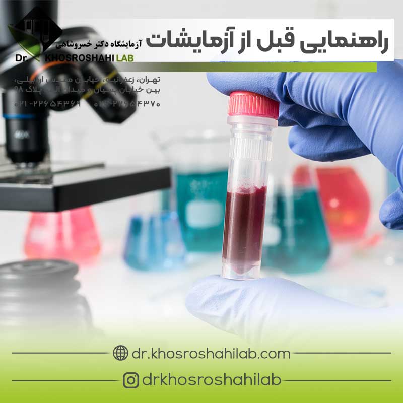 راهنمایی قبل از آزمایشات