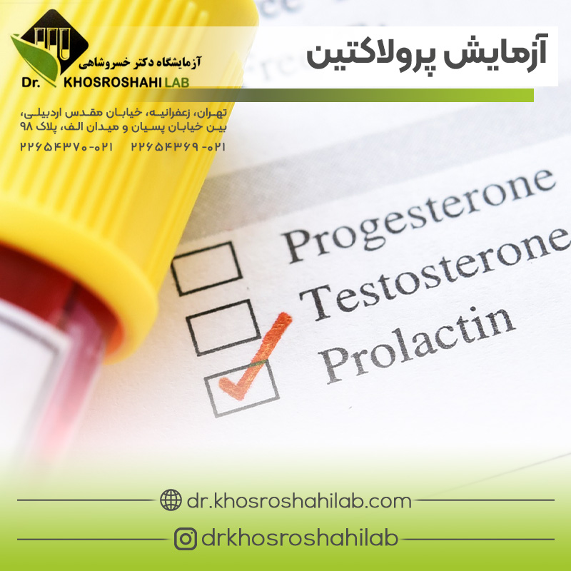 آزمایش پرولاکتین