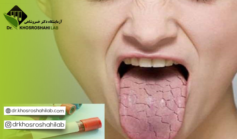 آزمایش های مرتبط به Anti SSA