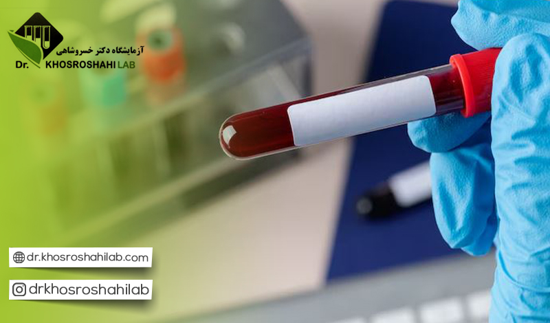 مراحل انجام تست آنتی بادی آنتی سانترومر یا ACA