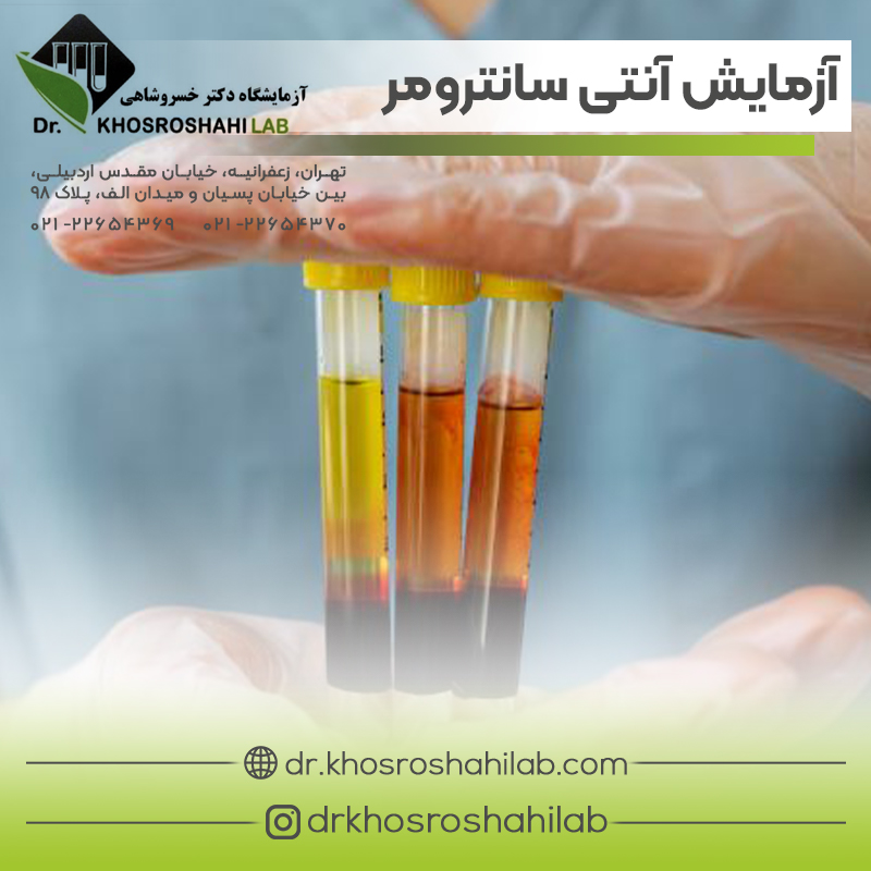 آزمایش آنتی سانترومر آنتی بادی (Anticentromere Antibody)