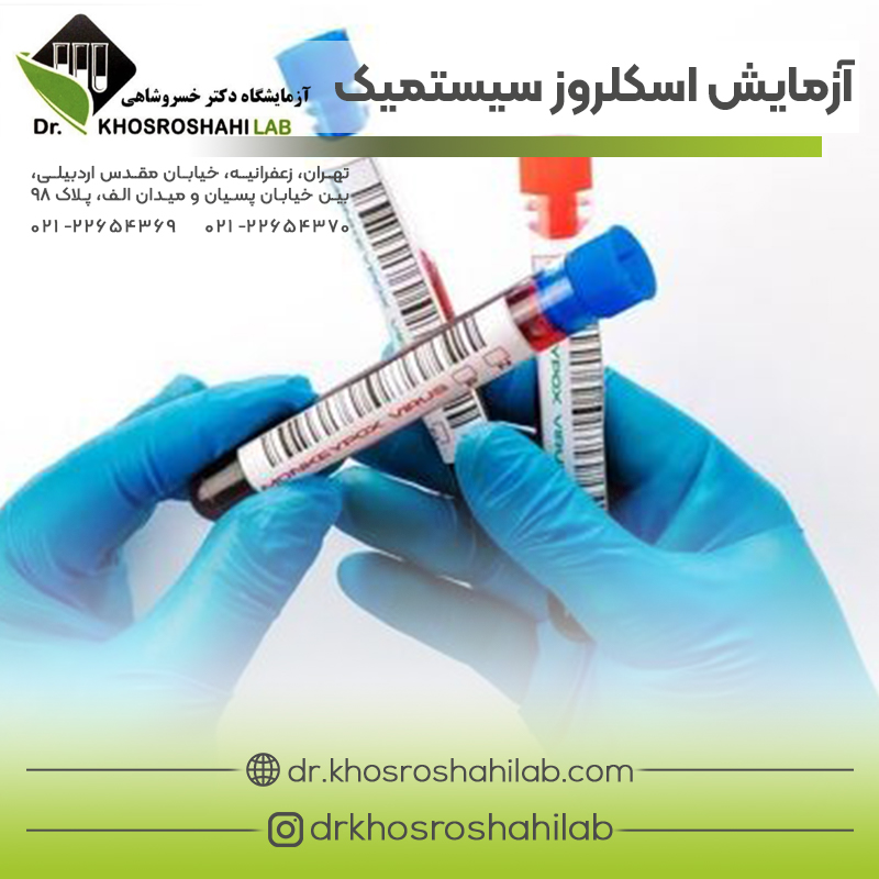 آزمایش آنتی بادی اسکلروز سیستمیک پیشرونده (SCL-70)