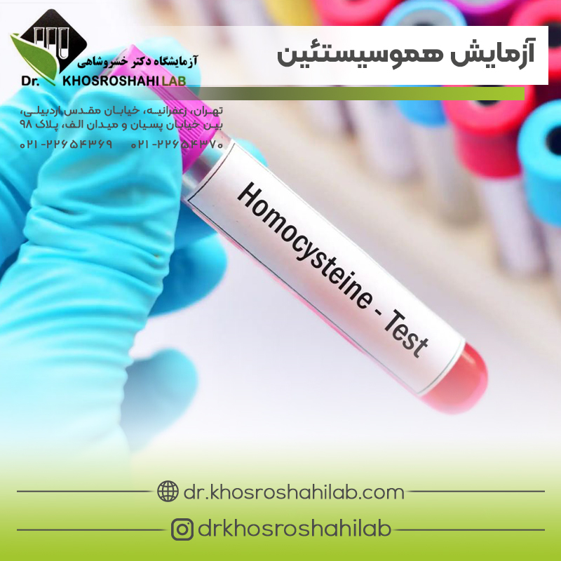 آزمایش خون هموسیستئین