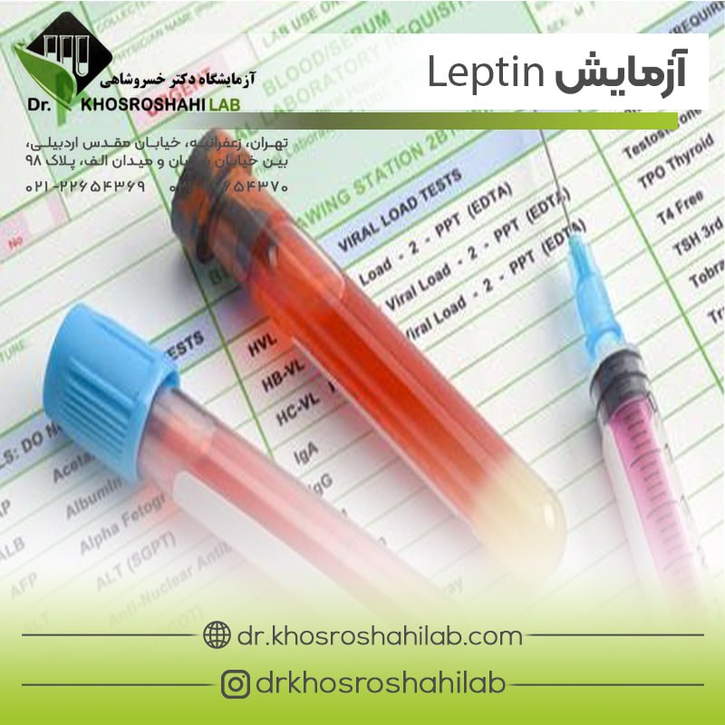 آزمایش لپتین (leptin)