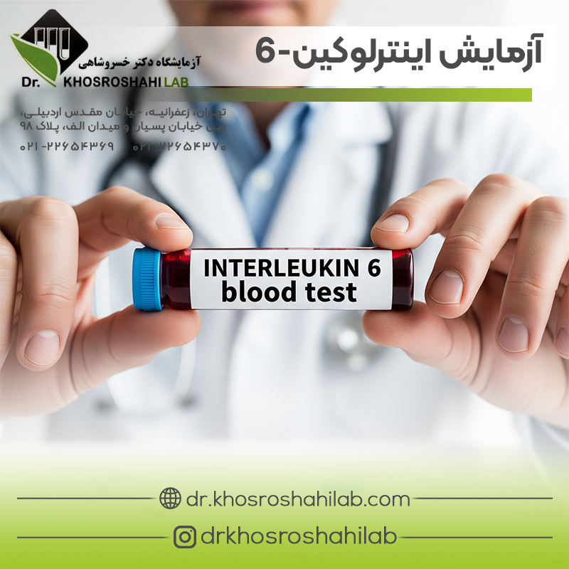 آزمایش اینترلوکین-۶