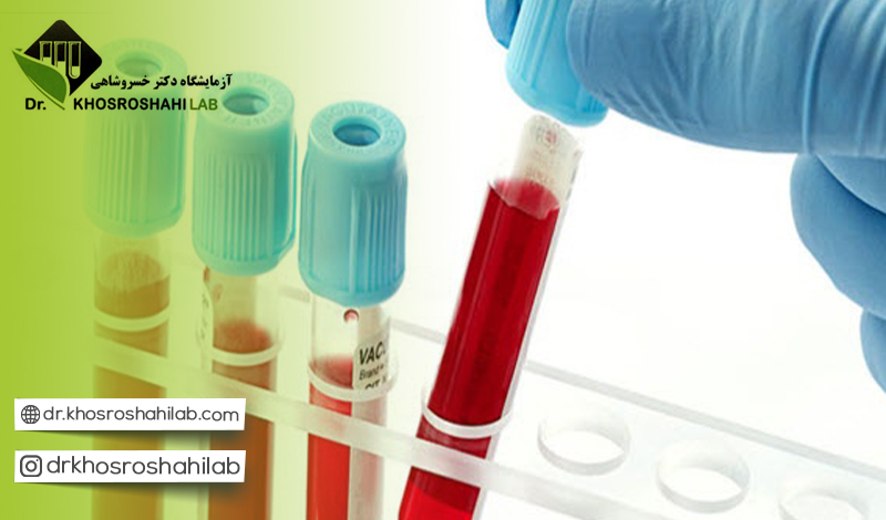 دلیل اهمیت آزمایش PROCALCITONIN
