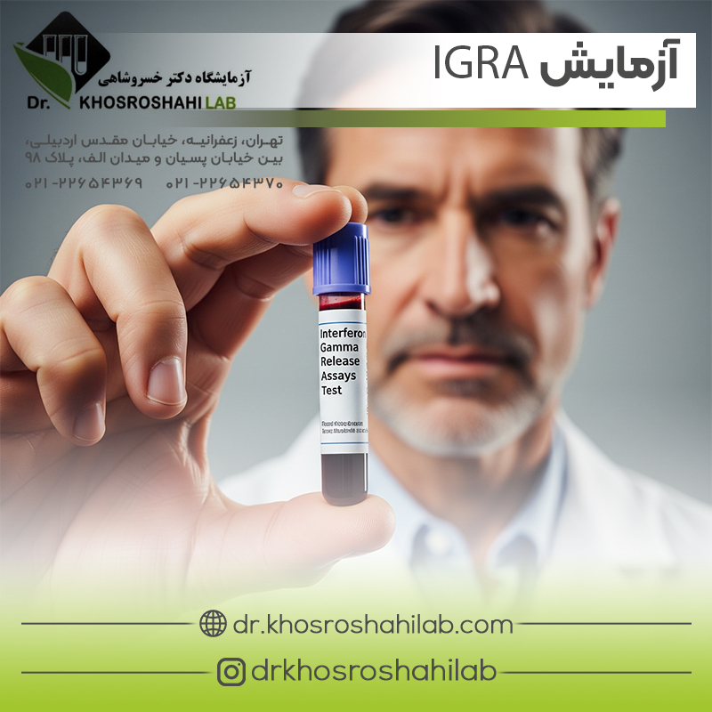 آزمایش Interferon Gamma
