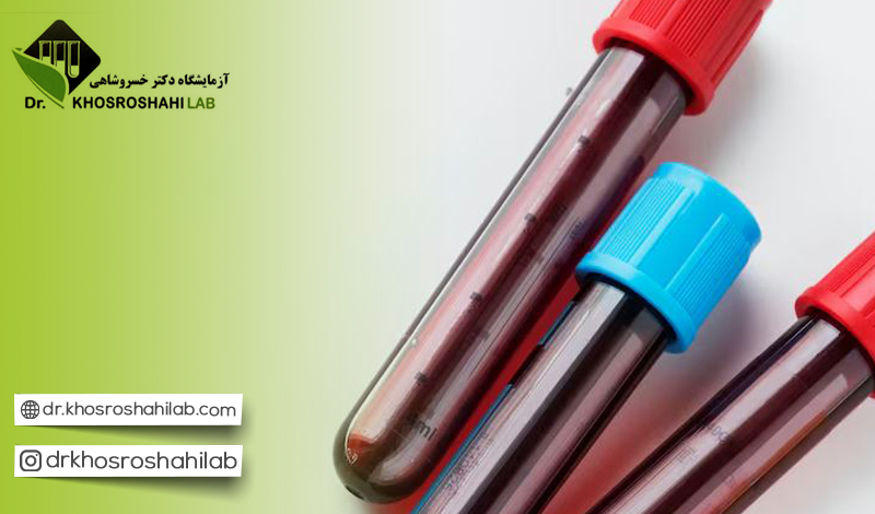 بررسی نتایج آزمایش خون آمونیاک