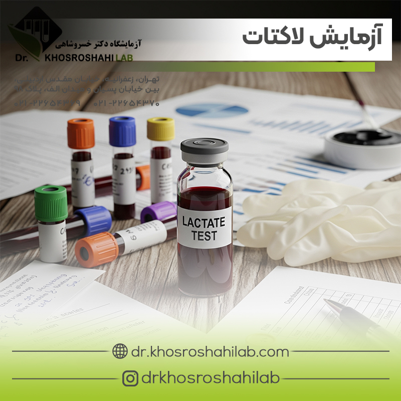 آزمایش لاکتات