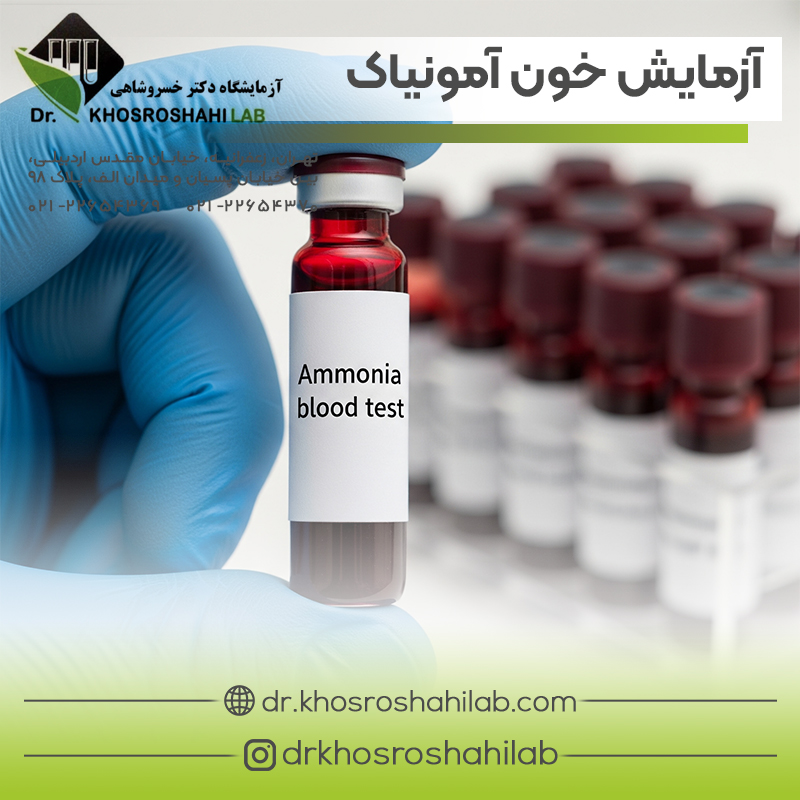 آزمایش خون آمونیاک