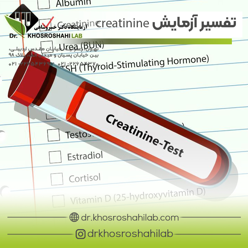 تفسیر آزمایش creatinine