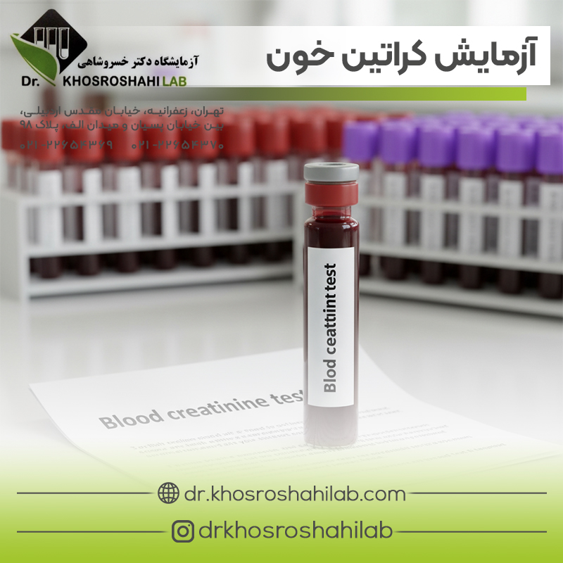 آزمایش کراتین خون