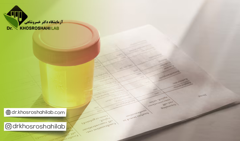 روش انجام آزمایش تشخیص عفونت ادرار