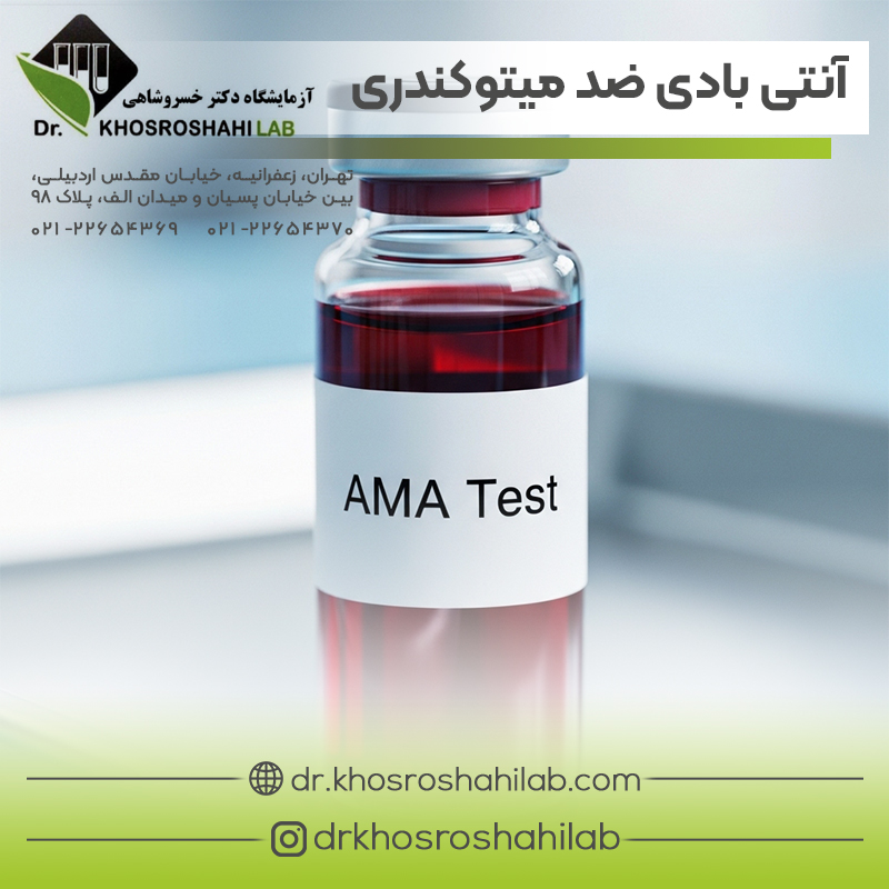 آزمایش آنتی بادی ضد میتوکندری