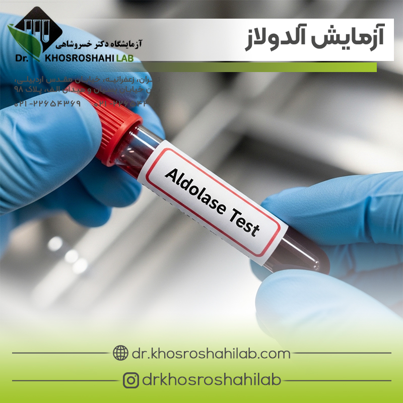 آزمایش آلدولاز