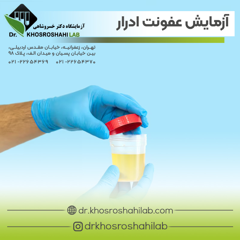 آزمایش تشخیص عفونت ادرار