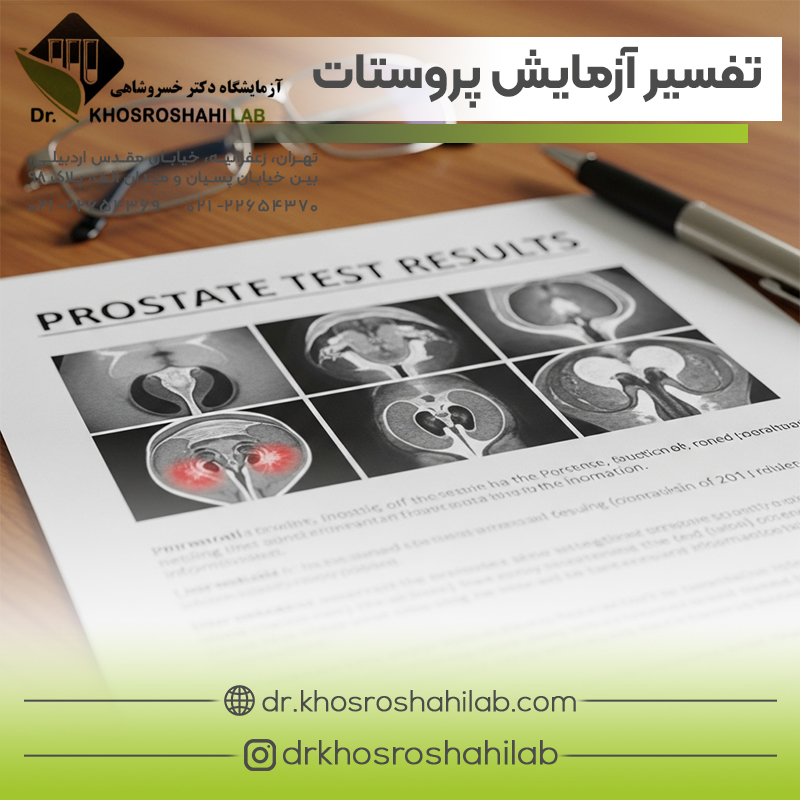 تفسیر آزمایش پروستات