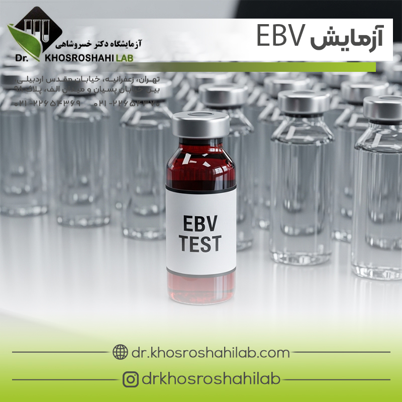 آزمایش EBV