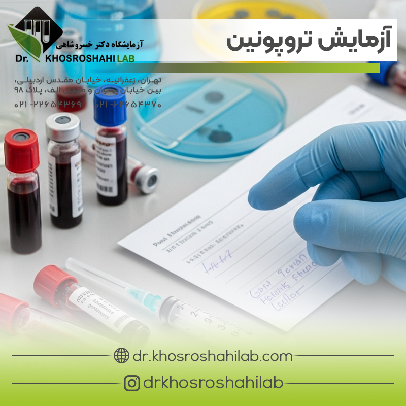 آزمایش تروپونین