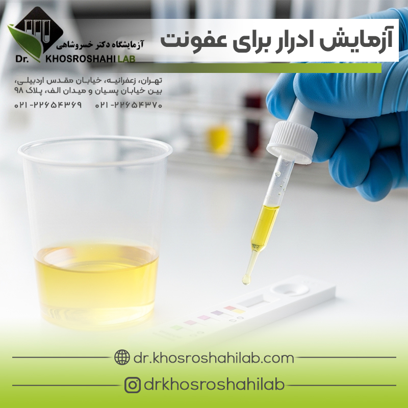 شرایط آزمایش ادرار برای عفونت های ادراری
