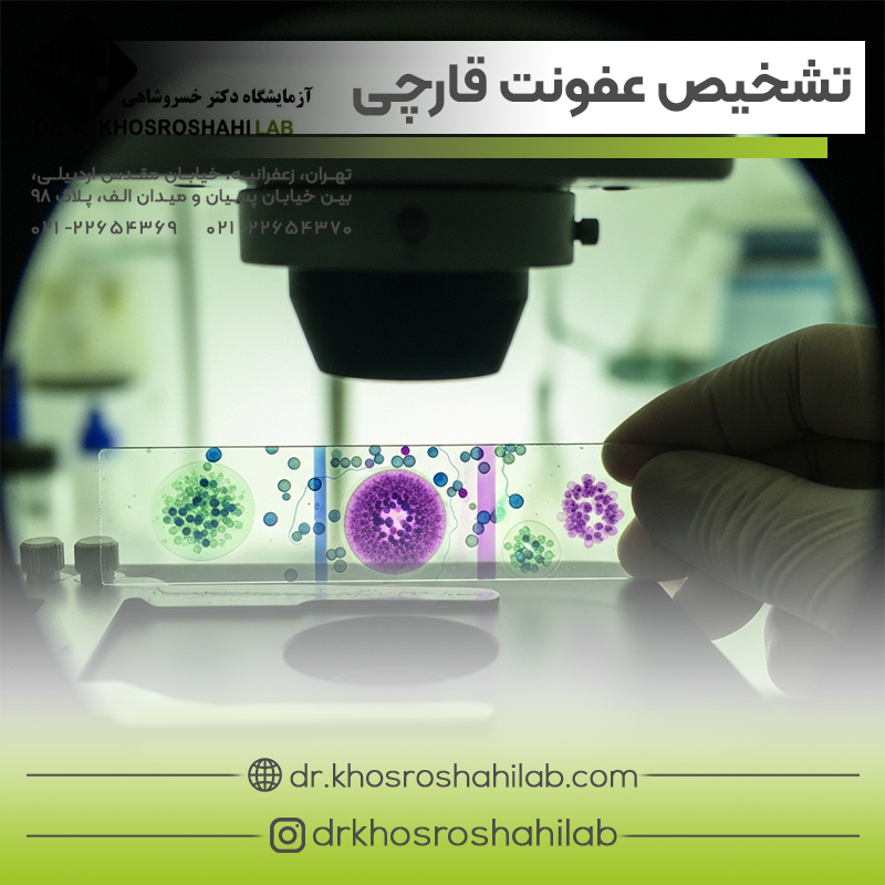 تشخیص آزمایشگاهی عفونت های قارچی