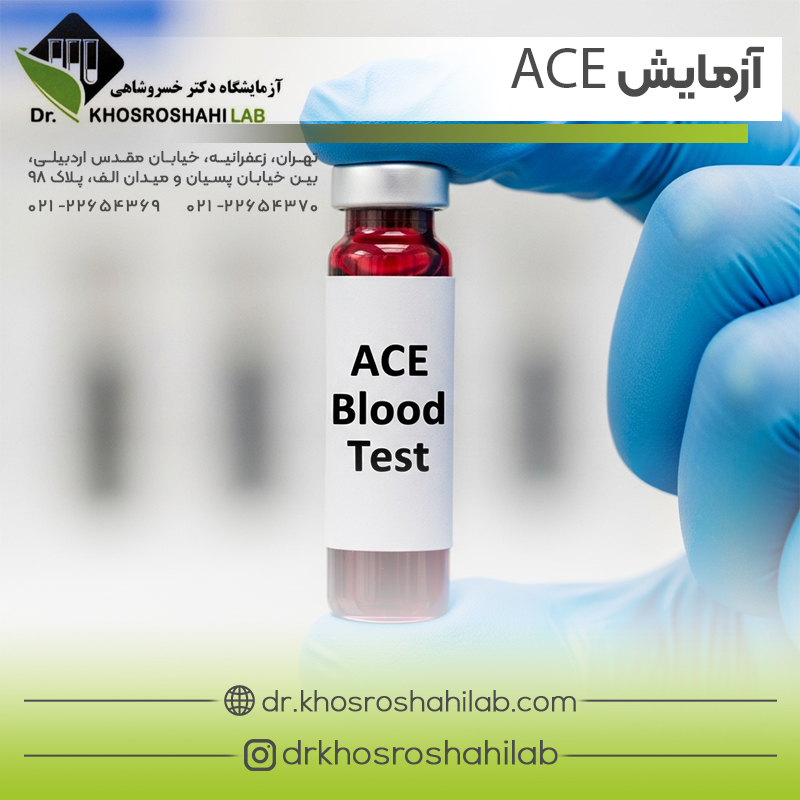 آزمایش A.C.E