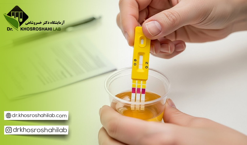 چه فاکتورهایی در تفسیر آزمایش ادرار ثبت میشود؟