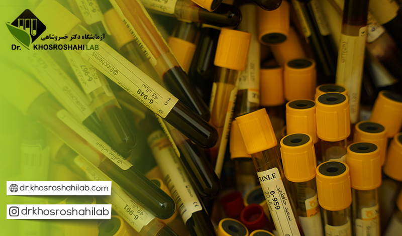 علت محبوبیت آزمایشگاه خسروشاهی