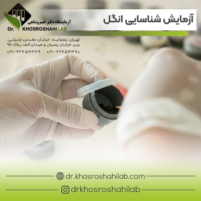 آزمایش مدفوع برای شناسایی انگل