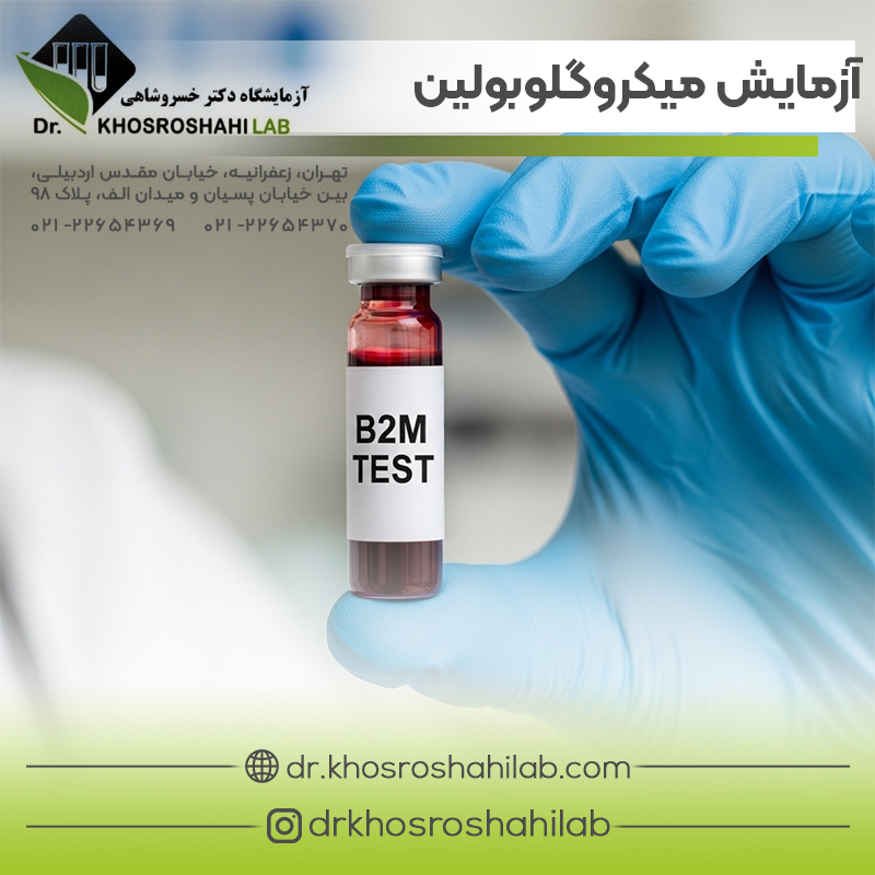 آزمایش بتا2 میکروگلوبولین
