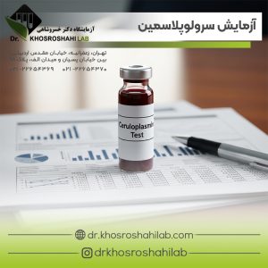 آزمایش سرولوپلاسمین
