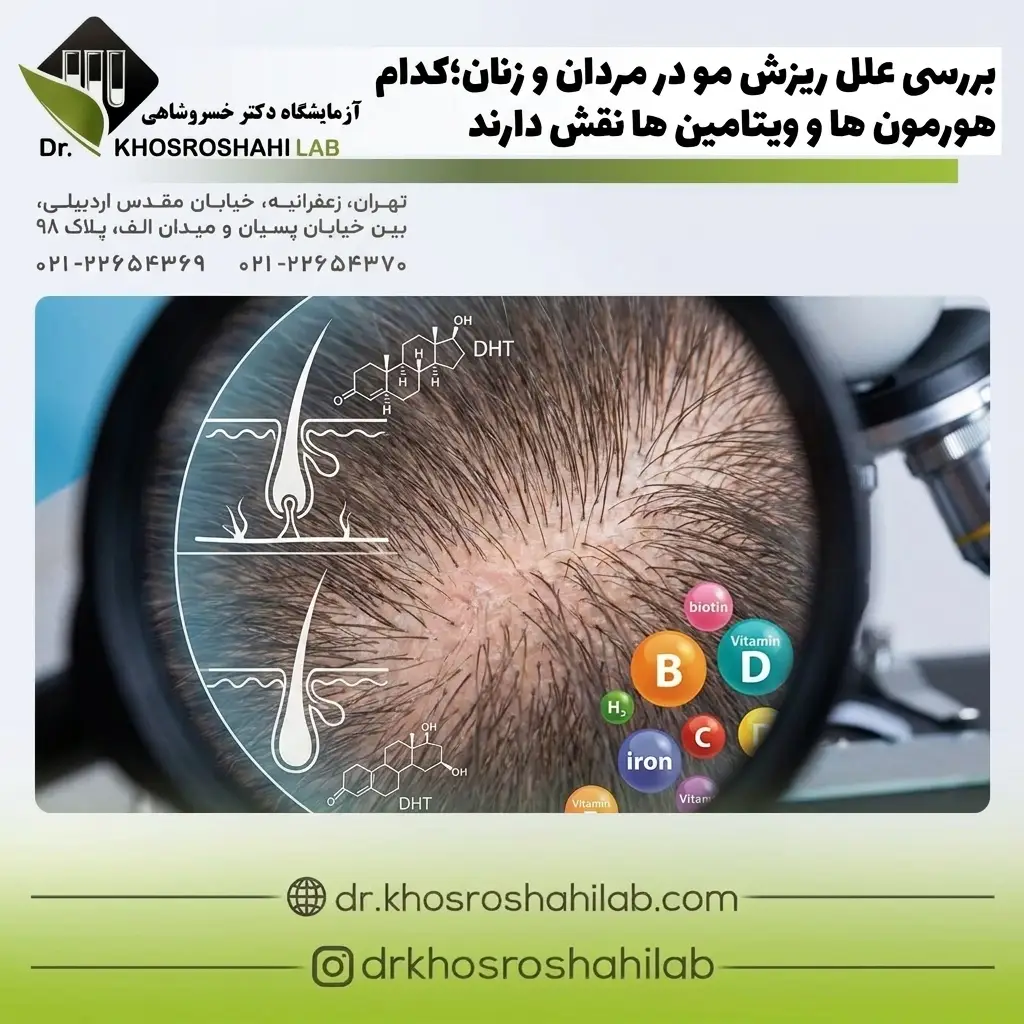بررسی علل ریزش مو در مردان و زنان؛کدام هورمون ها و ویتامین ها نقش دارند