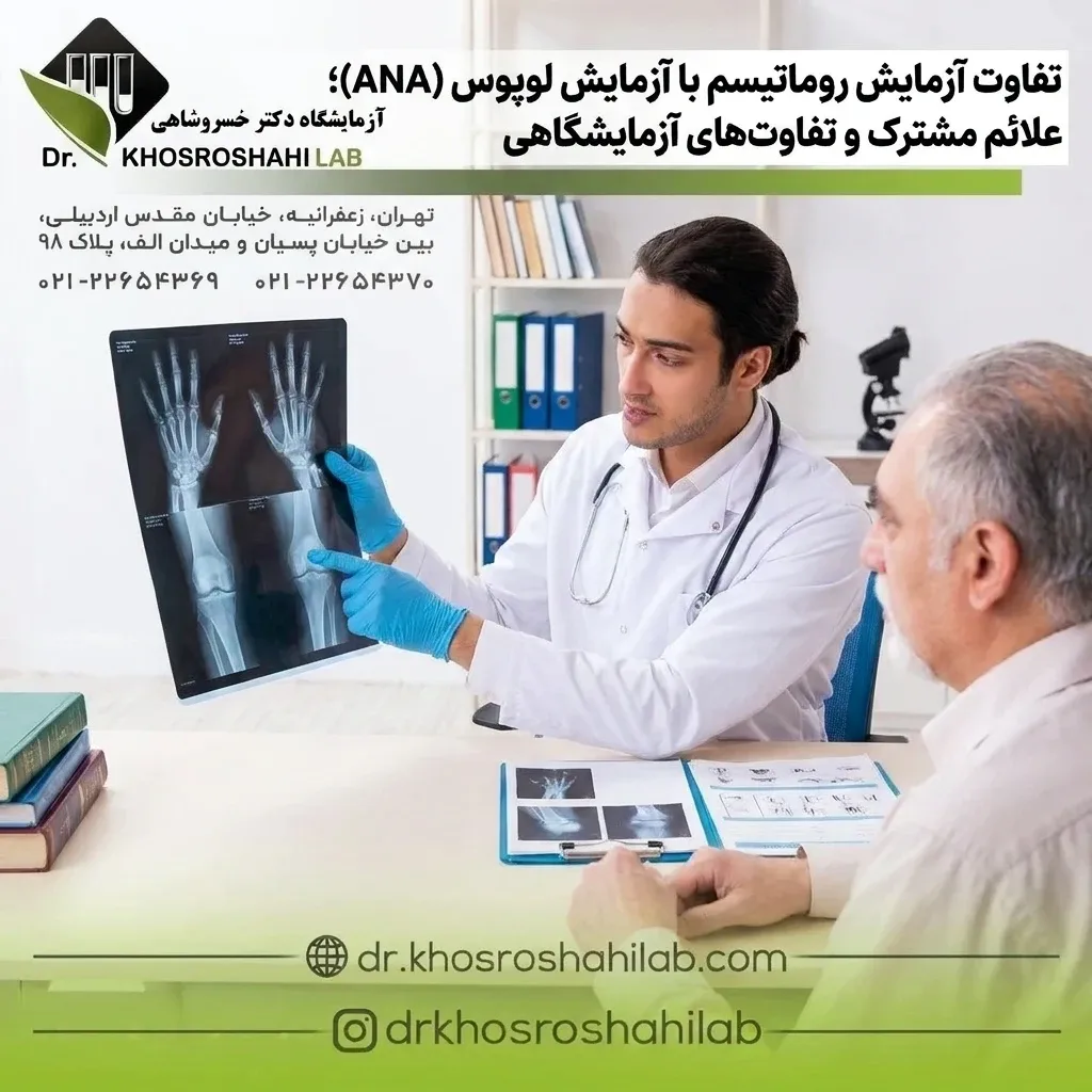 تفاوت آزمایش روماتیسم با آزمایش لوپوس (ANA)؛ علائم مشترک و تفاوتهای آزمایشگاهی